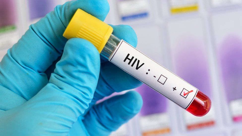 HIV positive blood test