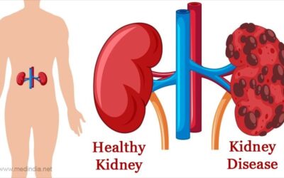 🚨 Heads up! Your Kidney is calling out to you. Top 10 reasons you may be developing kidney problems. Act now! 🚨