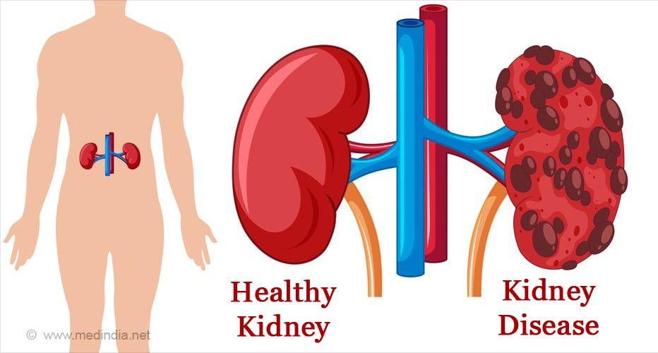 Top 10 reasons you may be developing kidney problems